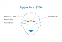 Upper face botox 350
