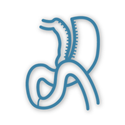 Representation of a Stomach After a Mini-Gastric Bypass Surgery