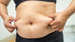 Expert Tips to Recover Faster After Gastric Sleeve Surgery