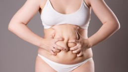 Types of Tummy Tucks: What Are the Differences?