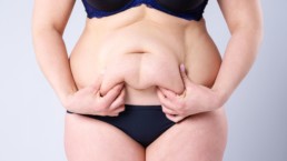Woman Holding Her Belly Fat