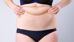 Everything You Need to Know About Tummy Tuck Surgery and Its Recovery Process